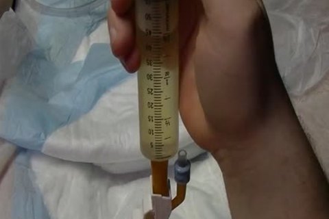 I insert A 24 French Catheter In Me. I Take In 500 ML Of Water In My Bladder. whilst My Bladder Is To The Bursting Point Play With Myself To The Point I spooge whilst Having A Full Bladder. At The End I Drain My Bladder Then Remove The Catheter.
